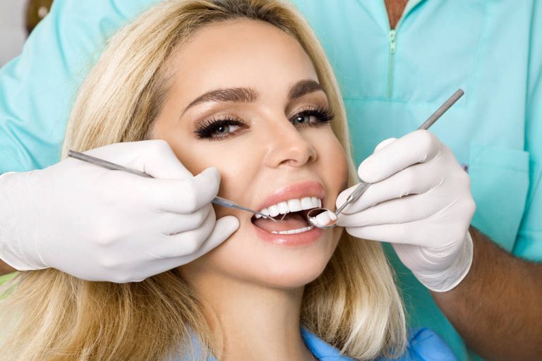 What is the price of a full set of veneers? awash